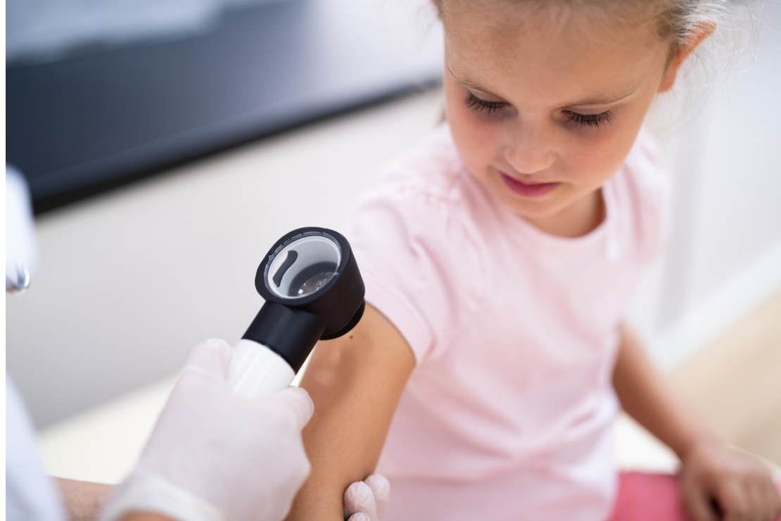 Pediatric Dermatology in Oklahoma City