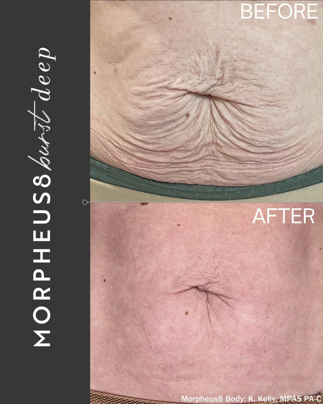 Luxora aesthetic before and after treatment comparison